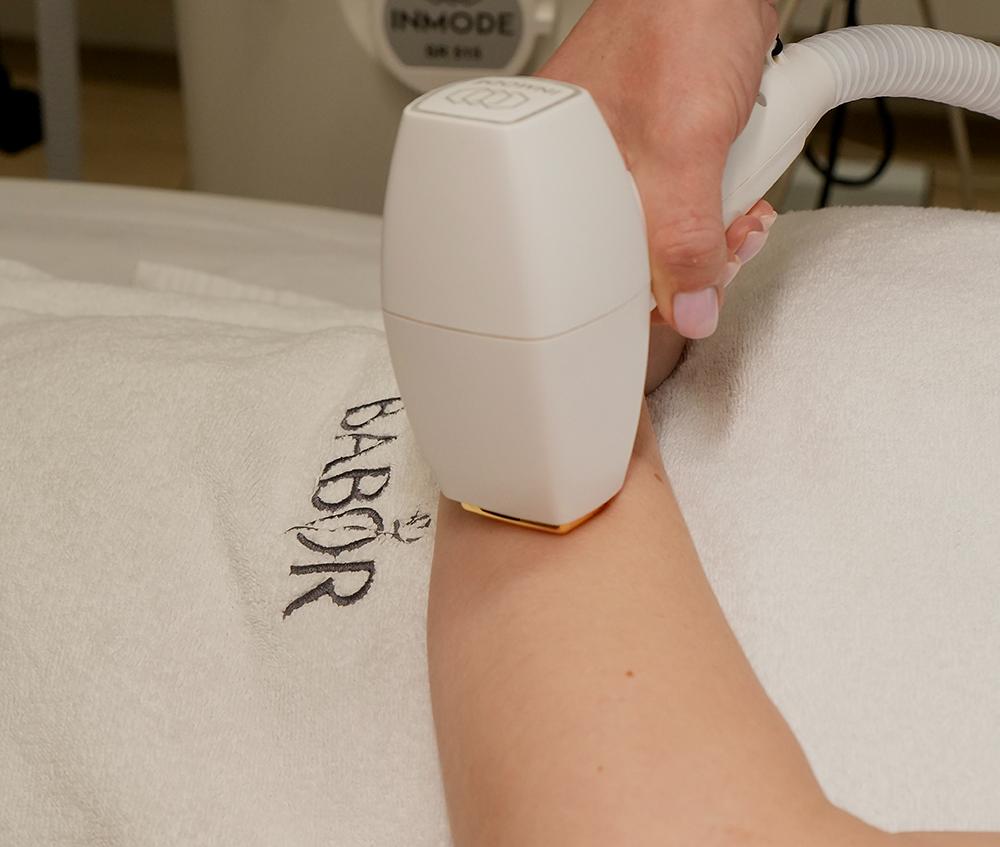 ЛАЗЕРНАЯ ЭПИЛЯЦИЯ (александрит/диод) DIOLAZE (Израиль)