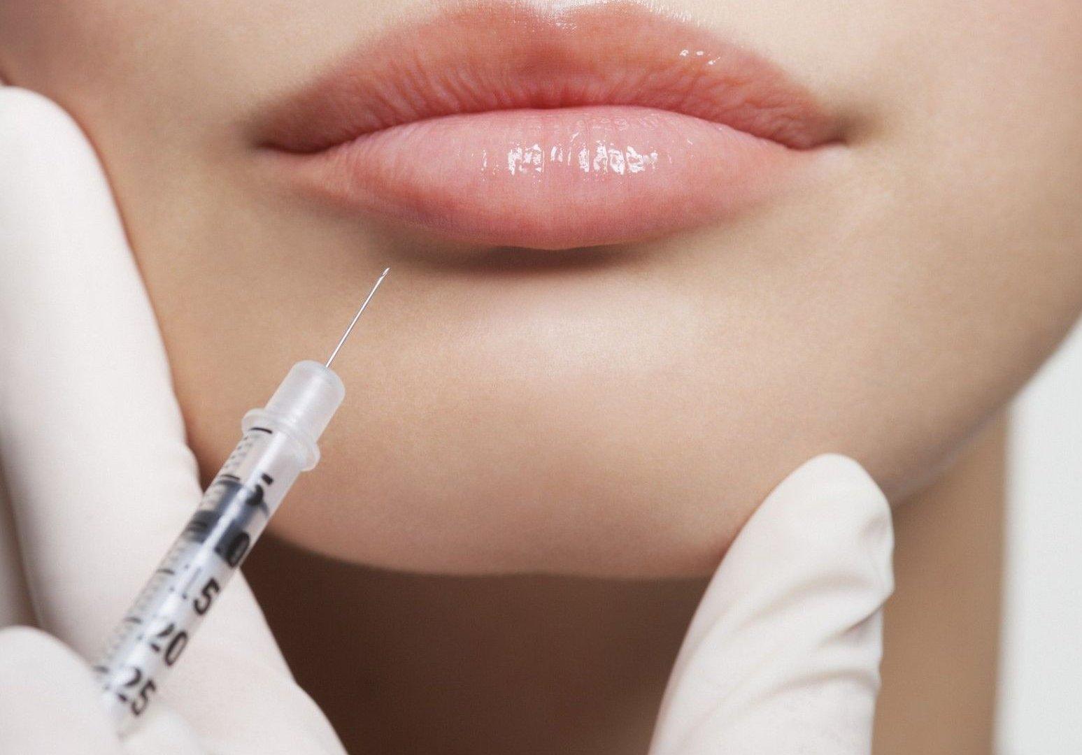 А11.01.013 Контурная пластика препаратом Belotero Lips Contour (0,6 мл)