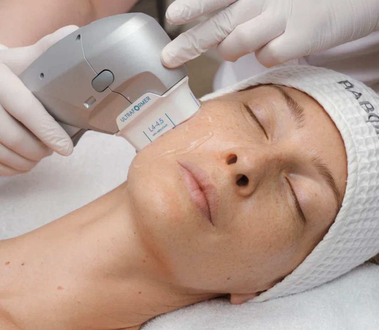 SMAS ЛИФТИНГ ULTRAFORMER III